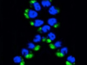 神奇：寄生虫的蛋白可以帮助机体对抗卵巢癌