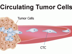 关于循环肿瘤细胞，你应该知道这些！