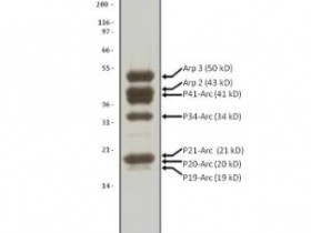 Cytoskeleton Arp2/3 蛋白复合物（猪脑）解决方案