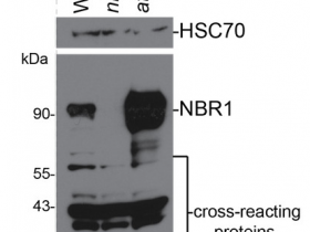 Agrisera热销产品PSII的NBR1 |自噬底物NBR1	AS14-2805说明书
