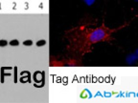 Flag抗体推荐—可进行WB/IF/IP检测的Flag标签抗体