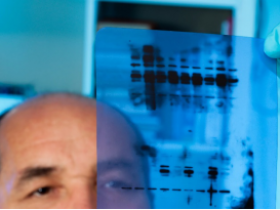 ECL之选:超乎想象的免疫印迹