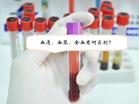 血清血浆的区别及溶血问题