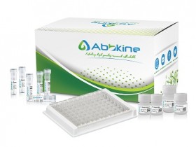 EliKineTM 高效&灵敏&可靠的大鼠 TNF-α ELISA试剂盒全新上市