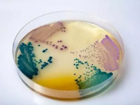 细胞培养基常见成分及功能