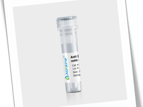 AbFluor 488偶联抗体:β-actin内参抗体（绿色荧光）