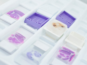 石蜡包埋组织样本RNA/DNA纯化方案:FFPE RNA/DNA纯化试剂盒