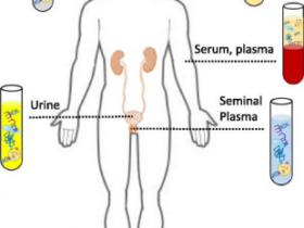 尿液收集和保存方案:Norgen尿液收集与保存管