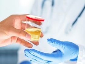 尿液cf-RNA分离方案:尿液游离RNA提取纯化试剂盒