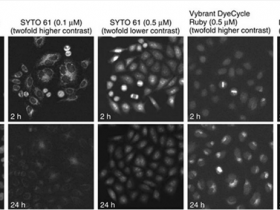 您不曾了解系列3:活细胞DNA染色
