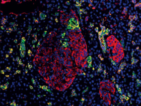 稀缺的亚型特异性单克隆二抗,打包都给你!