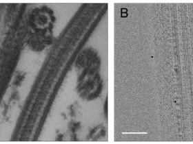 电子显微镜样本制备之固定篇