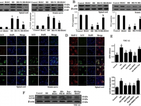 骨髓间充质干细胞(BMSC)抵抗正己烷诱导的神经病变