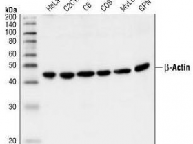 Image J实用技巧: Western Blot偏斜条带如何拉直