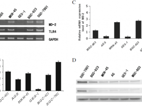 lps诱导的CXCR7表达通过TLR4/MD-2通路促进胃癌的增殖和迁移