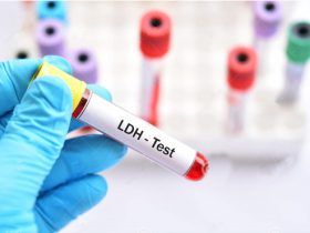 定量样本中LDH含量,选更简便的乳酸脱氢酶分析试剂盒!