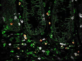 生物评论周报第93期：Cell：溃疡性结肠炎的耐药机制