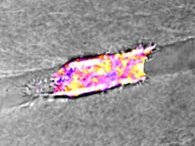 Nature Communications:治疗靶向代谢可能限制癌细胞的迁移和转移