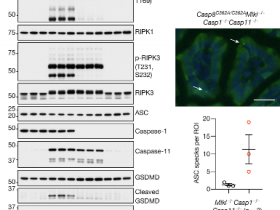 生物评论周报第104期：Nature :Caspase-8决定细胞死亡的不同方式