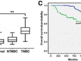 文献解读丨一种环状RNA 分子:乳腺癌预后的哨兵