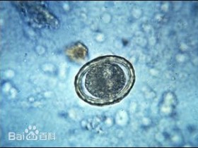 威胁人类健康的寄生虫,有哪些危害,以及如何防范?