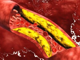 甘油三酯测定的意义