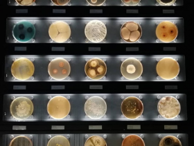 几种常见传染病及检测工具