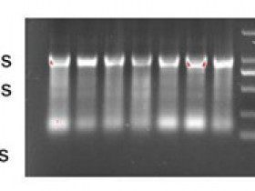 PCR疑难问题粉碎机(三)——逆转录PCR