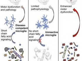 帕金森病相关研究
