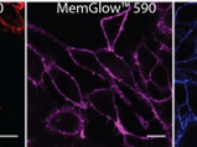 是什么让MemGlow™成为膜标记领域领导者?