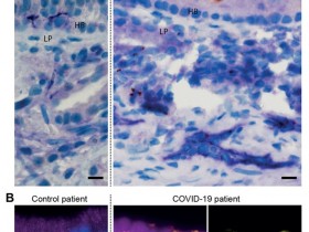 生物评论周报第140期:神经纤维蛋白-1促进SARS-CoV-2的细胞进入和感染