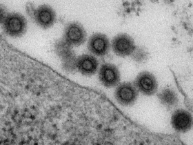 众多MLV研究文章引用——小鼠白血病病毒MLV（MuLV）核心抗原p30 ELISA试剂盒