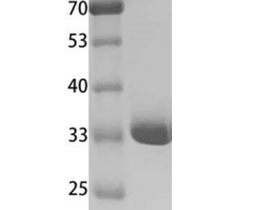 早期细胞凋亡检测：Annexin V/ANXA5重组人膜连蛋白A5