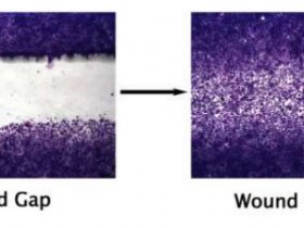 细胞划痕试剂盒,轻松搞定细胞划痕实验
