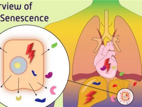 特色细胞衰老检测试剂盒怎么选?BioVision解决方案