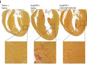 Science重磅封面:体内产生的CAR-T细胞可治疗心脏损伤