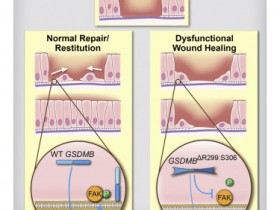 生物评论周报196期：Cell：GSDMB不依赖于焦亡来调节上皮的修复