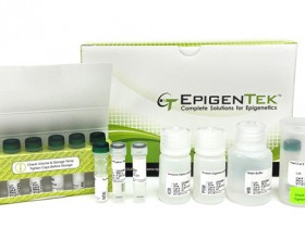 Epigentek 6月份最新表观遗传学研究论文