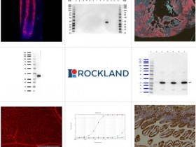 Rockland精选全能标签抗体产品解决方案