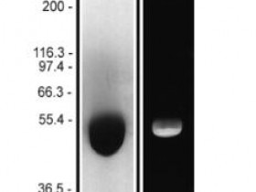 Cytoskeleton 微管蛋白（荧光 HiLyte 488）：猪脑说明书