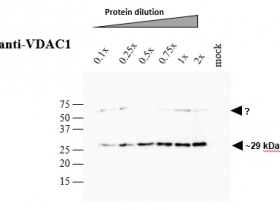 Agrisera PSII的VDAC1 |电压依赖性阴离子选择性通道蛋白1解决方案
