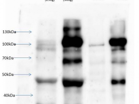 Agrisera热销产品——PSII的SE | Serrate RNA效应分子（兔抗体）