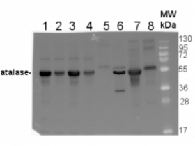 Agrisera热销产品Cat |过氧化氢酶(过氧化物酶体标记)说明书