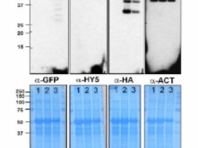 Agrisera热销产品HY5 |蛋白质长下胚轴5（AS12-1867）说明书