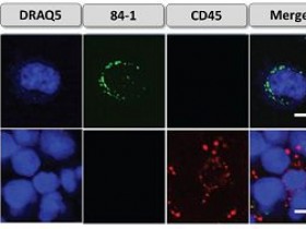 Abnova 细胞表面波形蛋白（CSV）单克隆抗体，克隆84-1解决方案