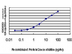 Abnova热销产品PLA2G7单克隆抗体（M02），克隆5D1说明书