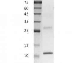 重组小鼠IL4/白介素4,无动物源&无载体蛋白