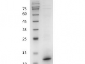 重组小鼠IL15/白介素15,无动物源&无载体蛋白