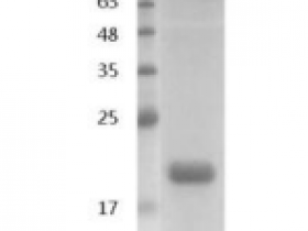 重组猪IL1β/白介素1β,无动物源&无载体蛋白