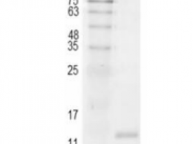 重组猪IL2/白介素2,无动物源&无载体蛋白